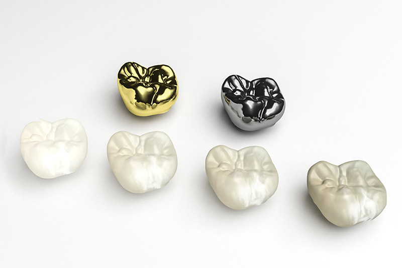 dental crowns near you